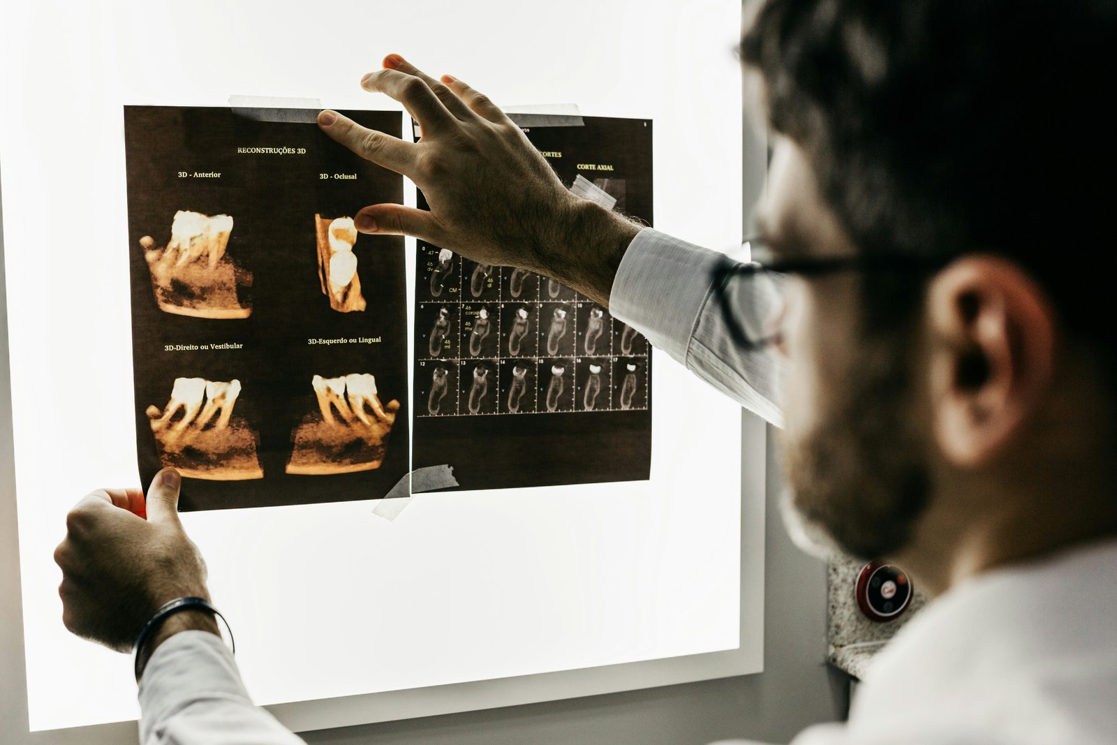 Tecnología de escaneo 3D